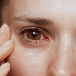 ojos rojos y resecos